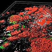 El atlas más completo del cáncer de mama, colon o páncreas explica cómo se expande