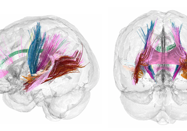 Este nuevo mecanismo del cerebro renueva constantemente la memoria