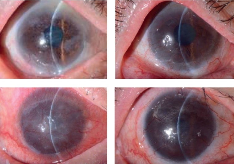 Los 10 avances más relevantes en salud de 2024, y para 2025