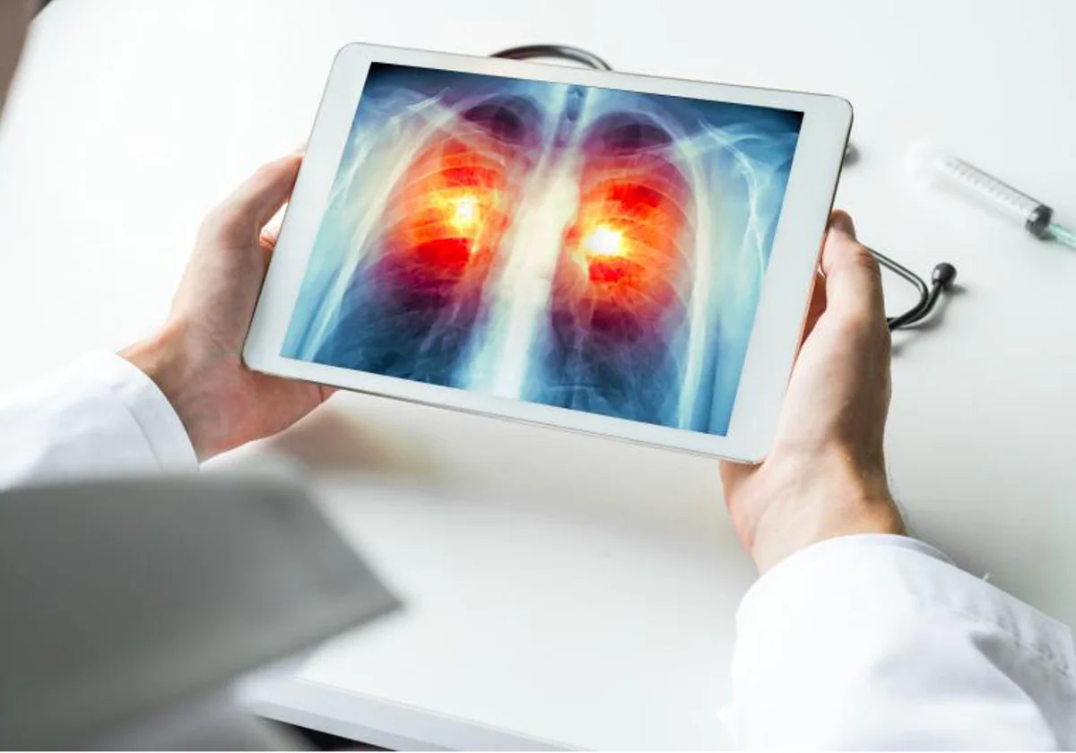 ¿Qué hace que los pulmones sean un lugar tan tentador para las células cancerosas?