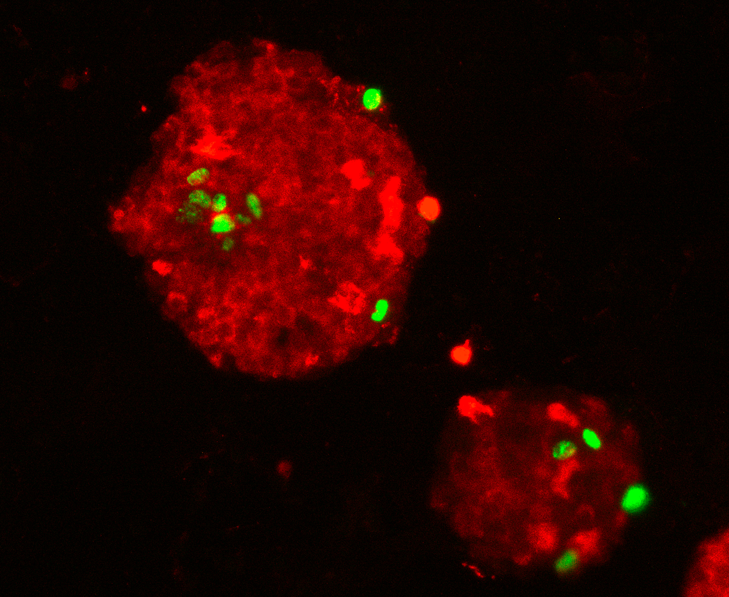 Explican la asociación entre microbioma humano y la diabetes