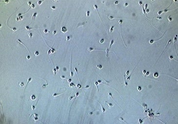 La calidad del semen de los españoles desciende un 17% en los últimos cinco años