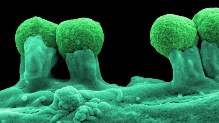 Una toxina, posible causa de la epidemia de cáncer colorrectal en jóvenes