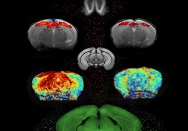 Actividad neuronal en los cerebros de ratones control (izquierda) y ratones con EP (derecha)