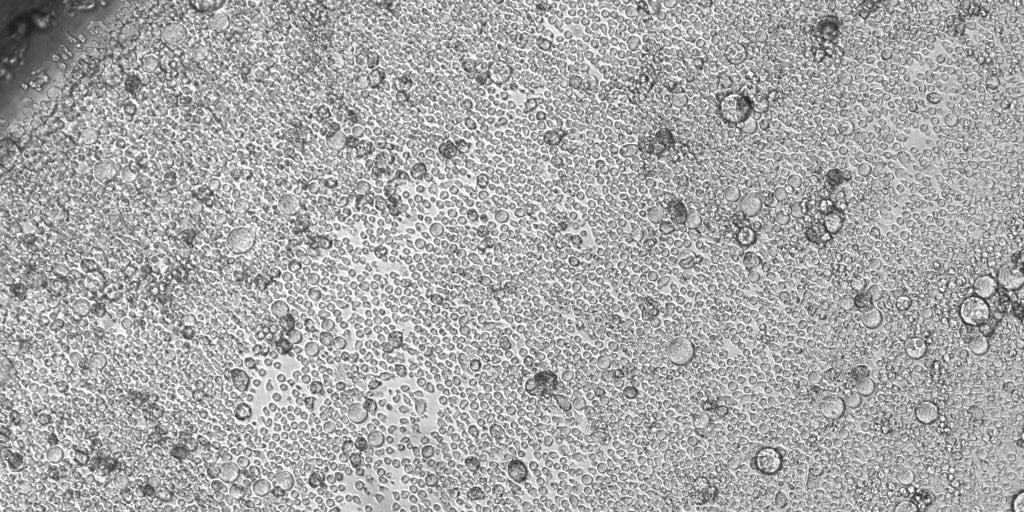 50歳から、一部の幹細胞は血液を制御し、多様性を失い、病気になる可能性が高くなります