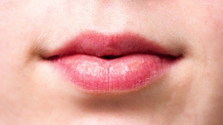 ¿Es el virus del herpes labial una causa desconocida de alzhéimer?