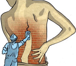 ¿Qué funciona para el dolor lumbar?