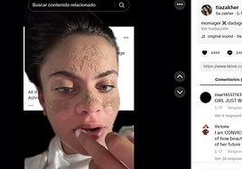 Así puede acabar tu piel con la 'rutina del cavernícola', la tendencia viral de no lavarse la cara