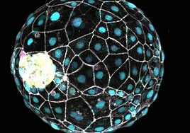 Detectan microplásticos en los fluidos reproductores de hombres y mujeres