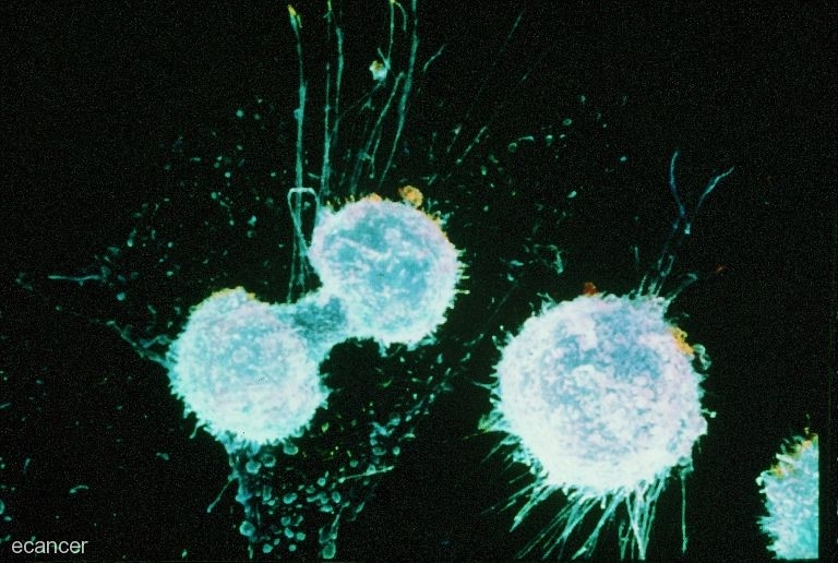 Células de cáncer de ovario en división