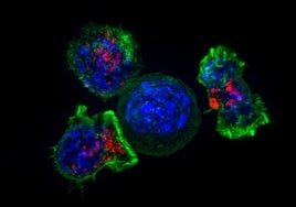 Un nuevo tratamiento frena el cáncer de próstata resistente en un 35%