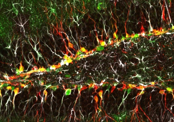 Neuronas