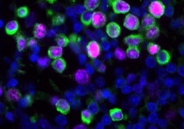 Un resfriado o una gripe despiertan células cancerosas ocultas en los pulmones