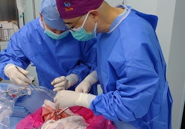 Realizan por primera vez un trasplante de pulmón de cerdo a humano