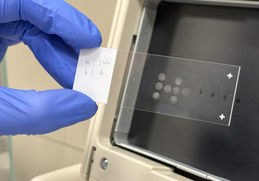 Una IA predice si una mutación genética derivará en una enfermedad