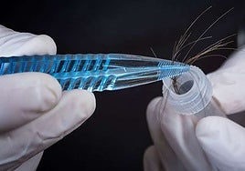 Con un único pelo se podría detectar la esclerosis lateral amiotrófica