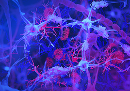 Explican cómo cambios moleculares generan el autismo y la esquizofrenia