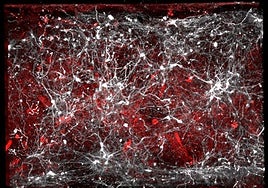 Ven por vez primera las proteínas que dan origen a la enfermedad de Parkinson