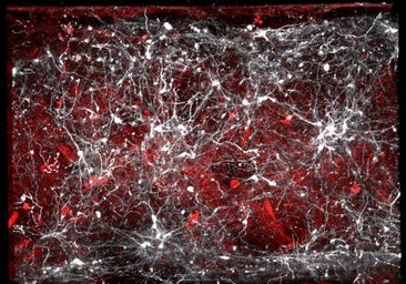 Ven por vez primera las proteínas que dan origen a la enfermedad de Parkinson