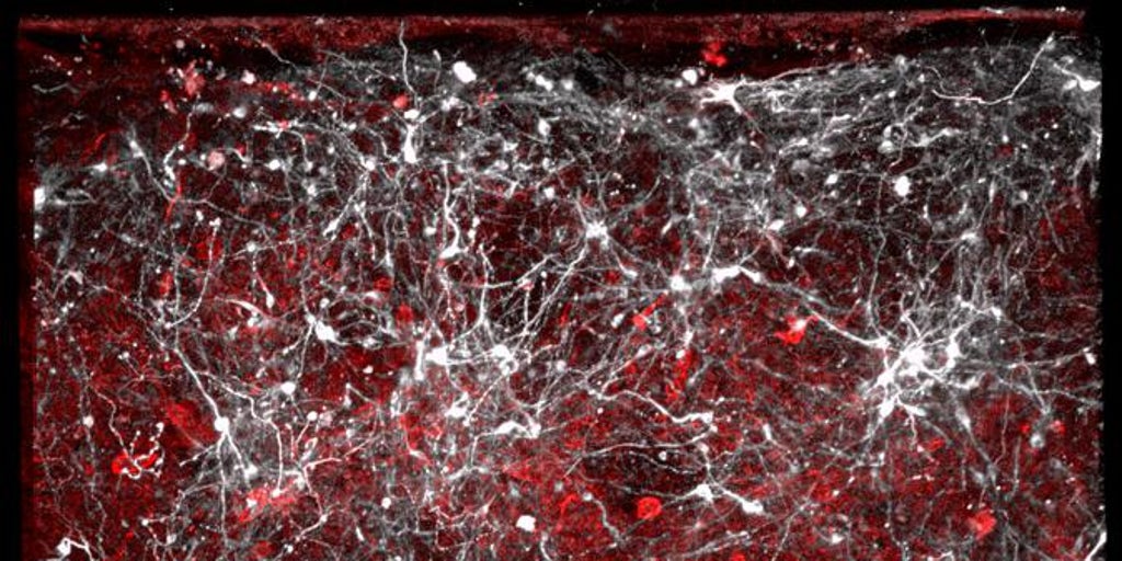Ven por vez primera las proteínas que dan origen a la enfermedad de Parkinson