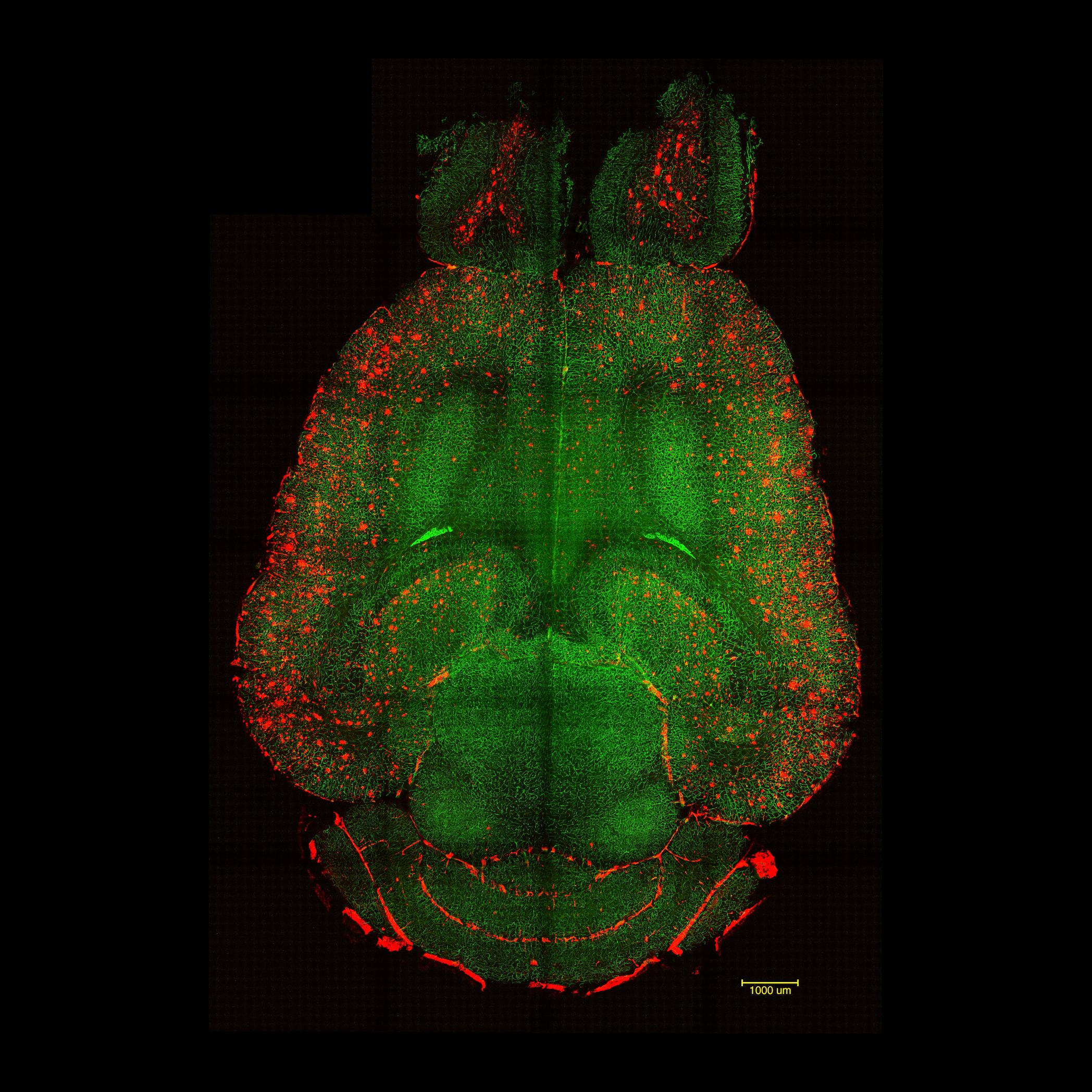 Imágenes de microscopía de fluorescencia basada en hoja de luz del cerebro de un ratón 12 horas después de no haber sido tratado con nanopartículas