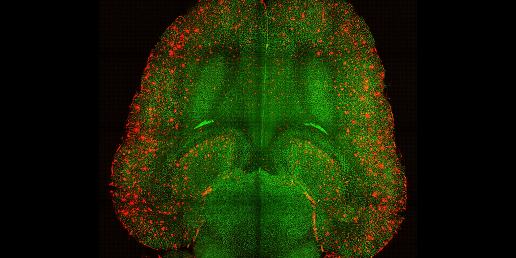 Una terapia con nanopartículas revierte el alzhéimer en ratones