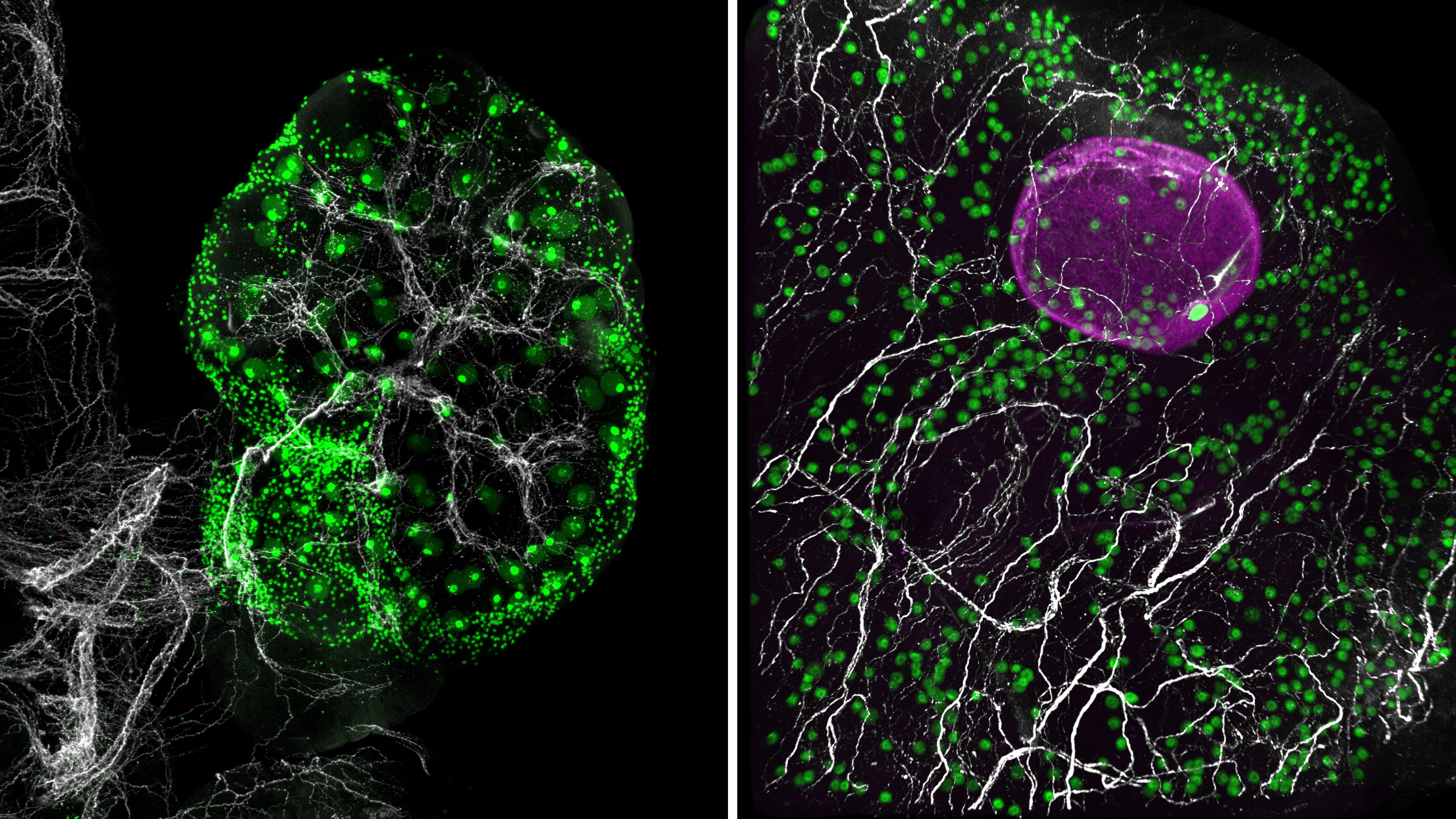 Una red de nervios simpáticos (blanco) recorre todo el ovario del ratón (izquierda) y un fragmento de ovario humano (derecha), creciendo junto a los óvulos (verde)