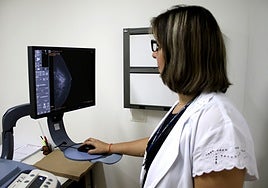 Una IA identifica a mujeres con alto riesgo de un cáncer de mama de mal pronóstico