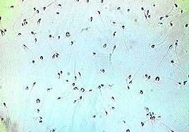 La IA logra un embarazo imposible tras detectar los dos únicos espermatozoides viables de un hombre