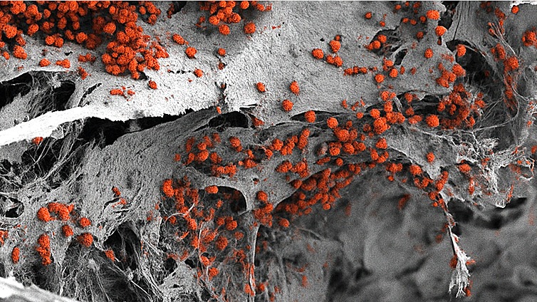 Fabrican un modelo de médula ósea completo a partir de células humanas