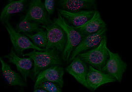 Eliminar las células 'viejas' revierte la inflamación y mejora la diabetes