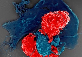 La inmunoterapia CAR-T llega a la forma más común de enfermedad cardíaca