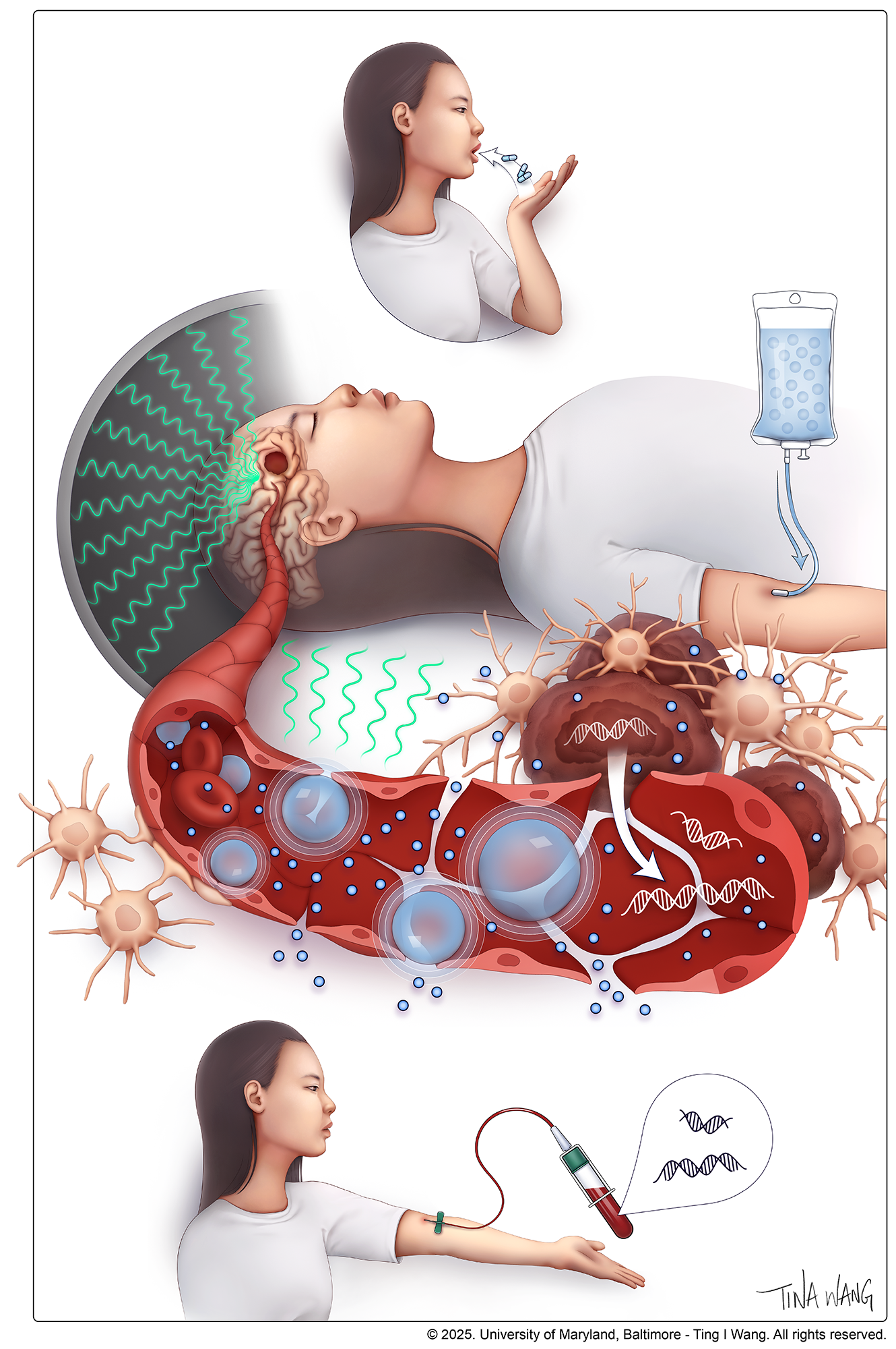 Chart of the new treatment