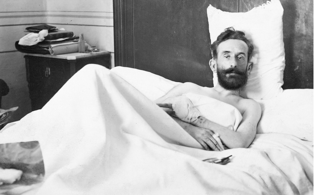 El doctor José Manuel de Puelles, postrado en la cama víctima de sus experimentos de radiología