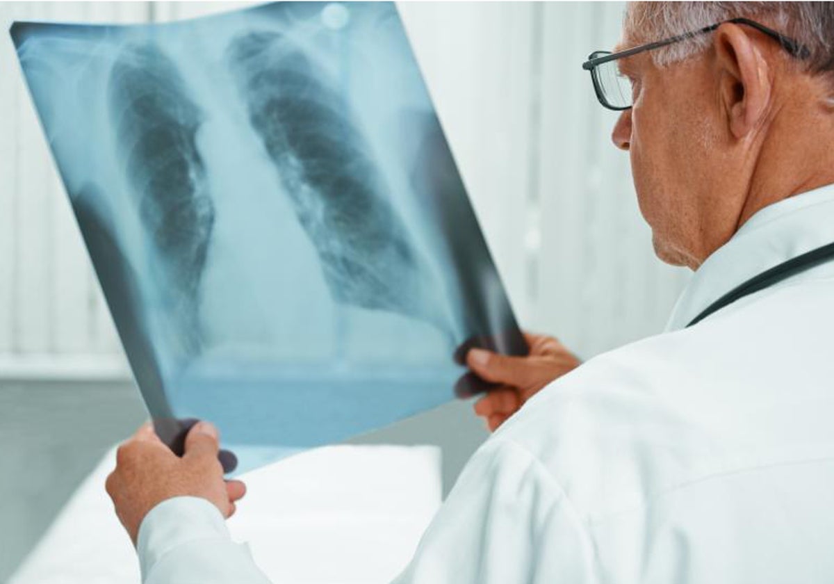 Un neumólogo observa una radiografía pulmonar