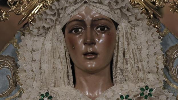 Imagen antes - Comparativa del rostro de la Macarena antes y después de la intervención