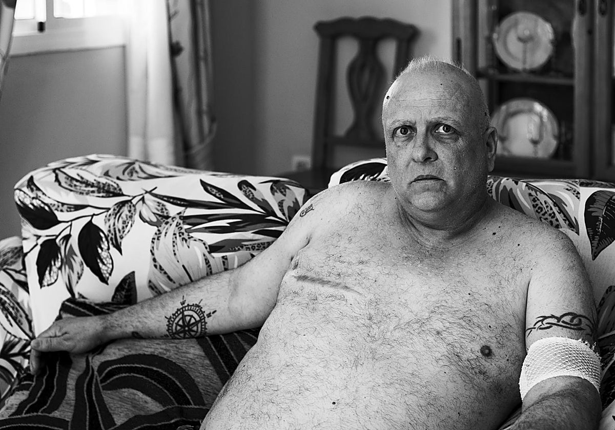 Chema se está recuperando de una operación de cáncer de mama