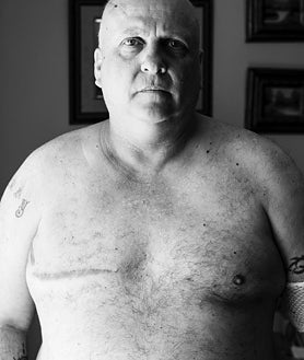 Imagen secundaria 2 - El hecho de que sea una dolencia infrecuente en hombres no ha impedido que Chema García luche por visibilizar la enfermedad