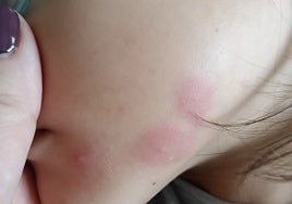 La AMPA del colegio Jacaranda de Sevilla Este avisa de alumnos con «enormes picaduras de insectos» por el polvo y la «mugre»