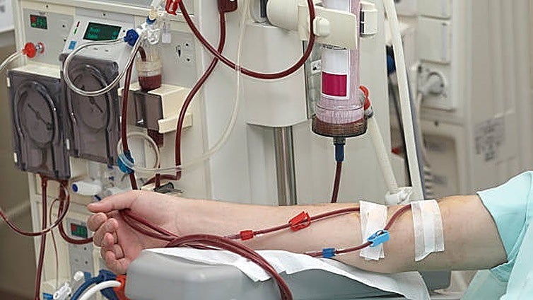 La Junta autoriza la contratación del servicio de hemodiálisis en Sevilla por más de 127 millones