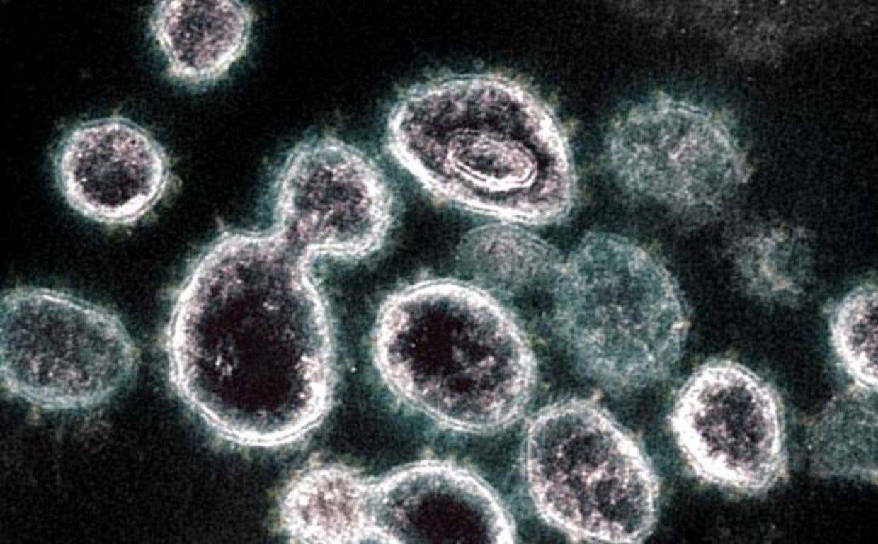 Imagen microscópica del Virus SARS-COV-2