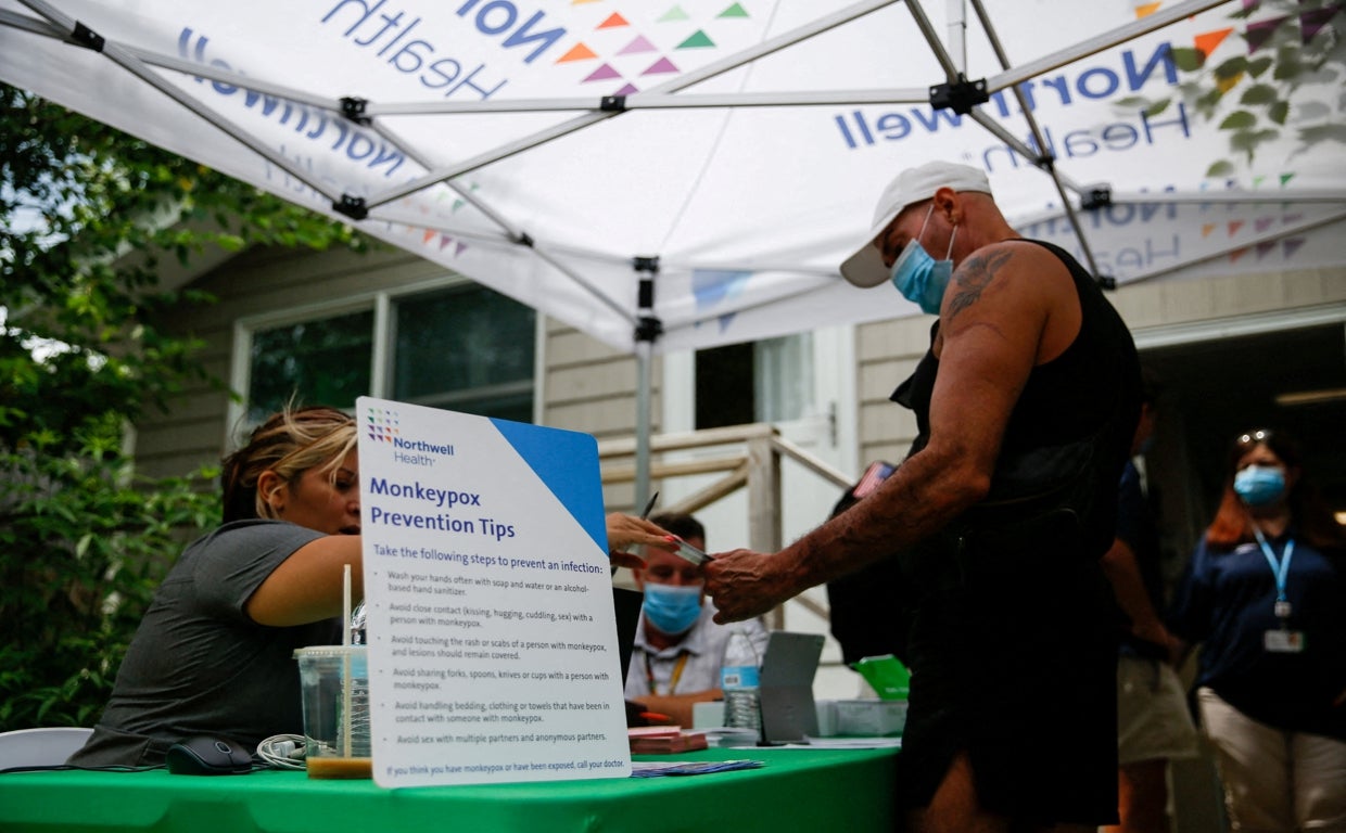 Estado de emergencia en Nueva York por la viruela del mono