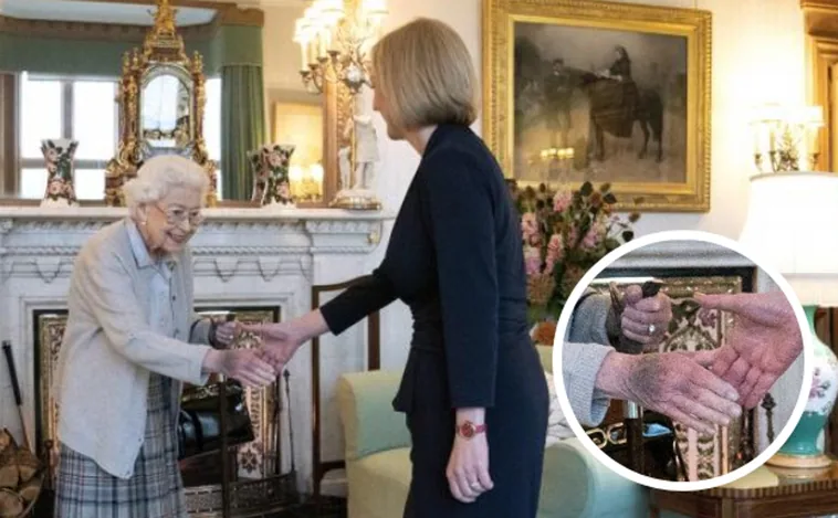 Por qué la Reina Isabel II tenía la mano negra dos días antes de su muerte
