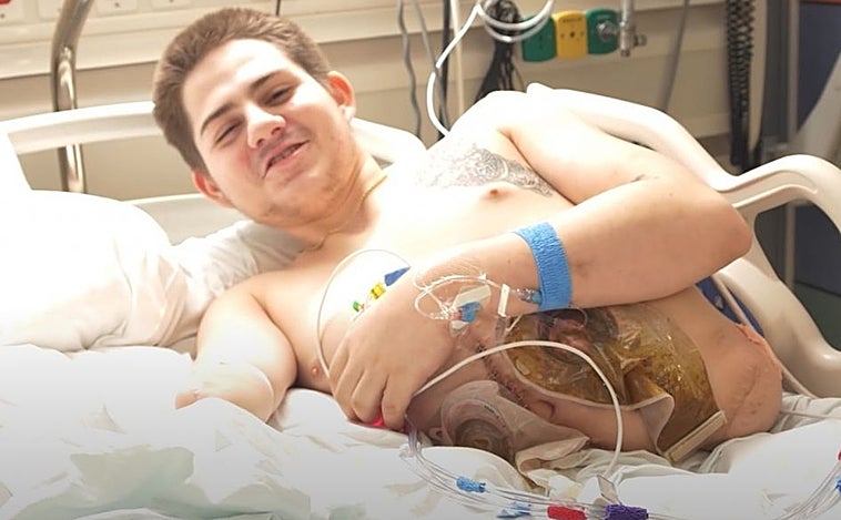 La nueva vida del joven que perdió la mitad del cuerpo tras aplastarle un montacargas: «Estaré alegre, aunque muera de dolor»