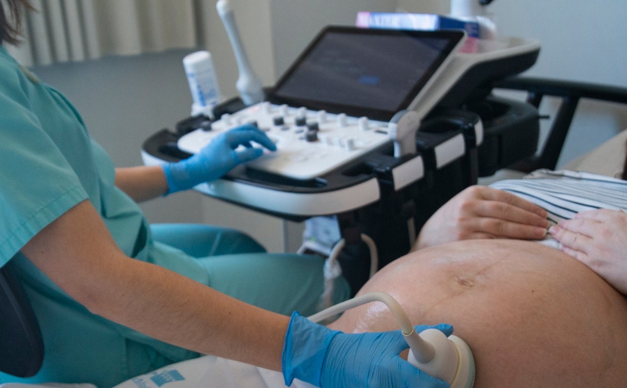 Imagen de archivo de una embarazada en una ecografía