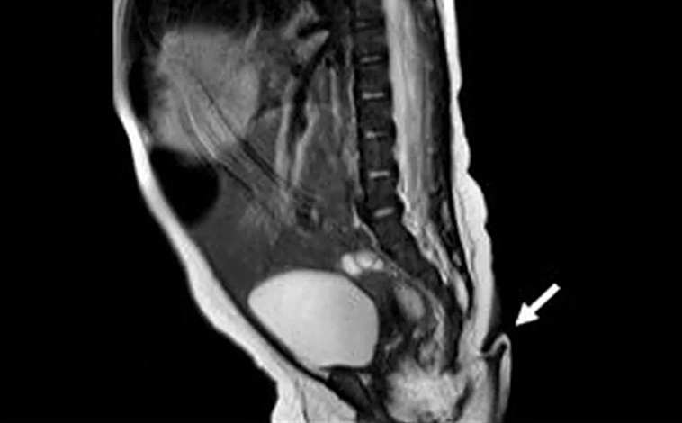 Imagen principal - Imágenes de la cola de la bebé de México