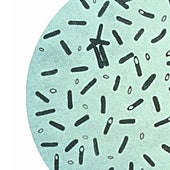 Europa detecta 14 casos de botulismo en personas que se sometieron en Turquía a operaciones para adelgazar