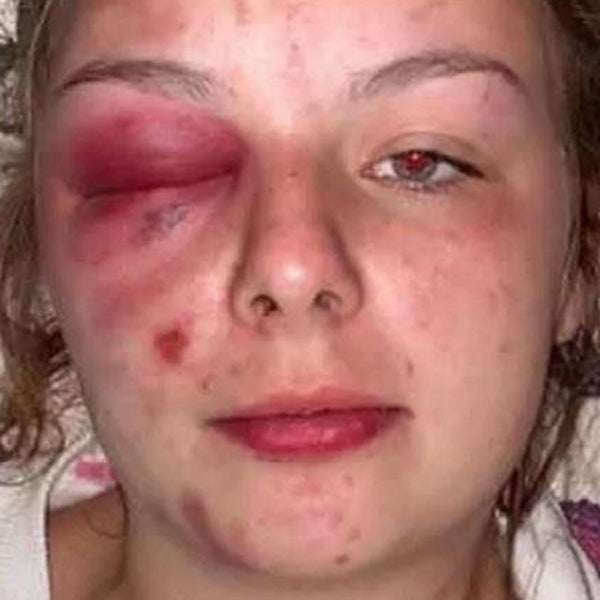 Condenan a ocho años y medio de cárcel a una joven que falseó una violación y se autolesionó con un martillo