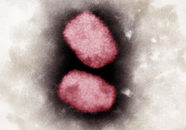 Europa teme que los casos de viruela del mono vuelvan a aumentar esta primavera