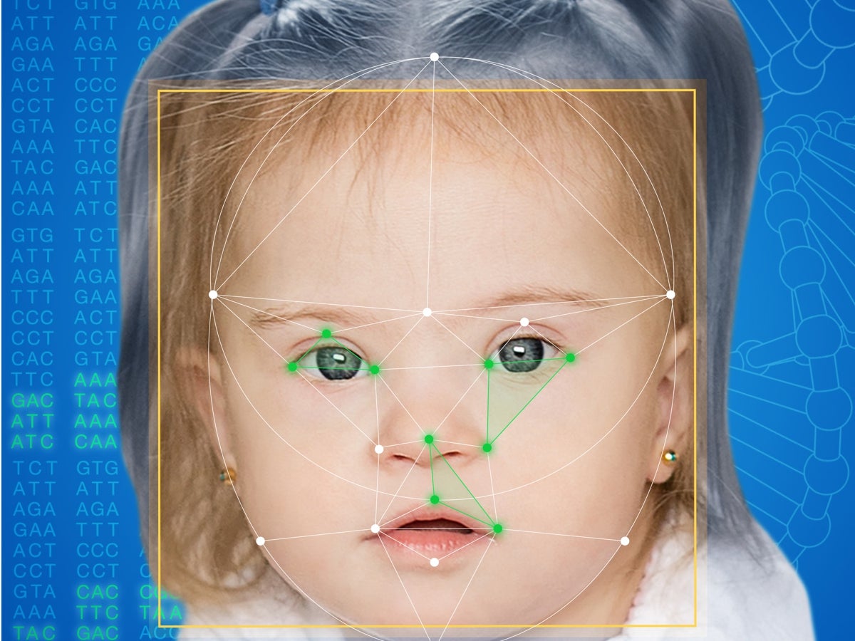 Así es la tecnología que diagnostica enfermedades genéticas a partir de una foto